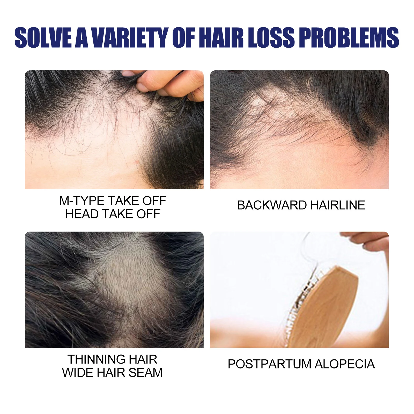 N Mousse Uomo Capelli Folti Riparazione Profonda Cura Rinforza, dona volume, riduce la caduta e migliora la salute dei capelli. — foto 6