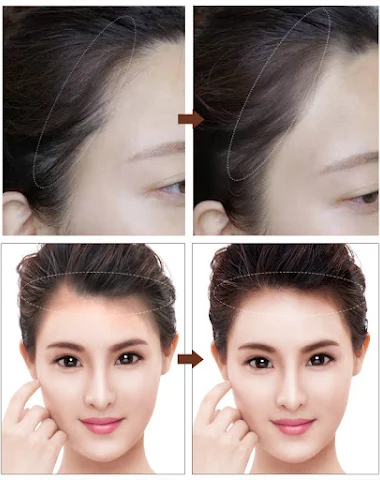 Image product - 2