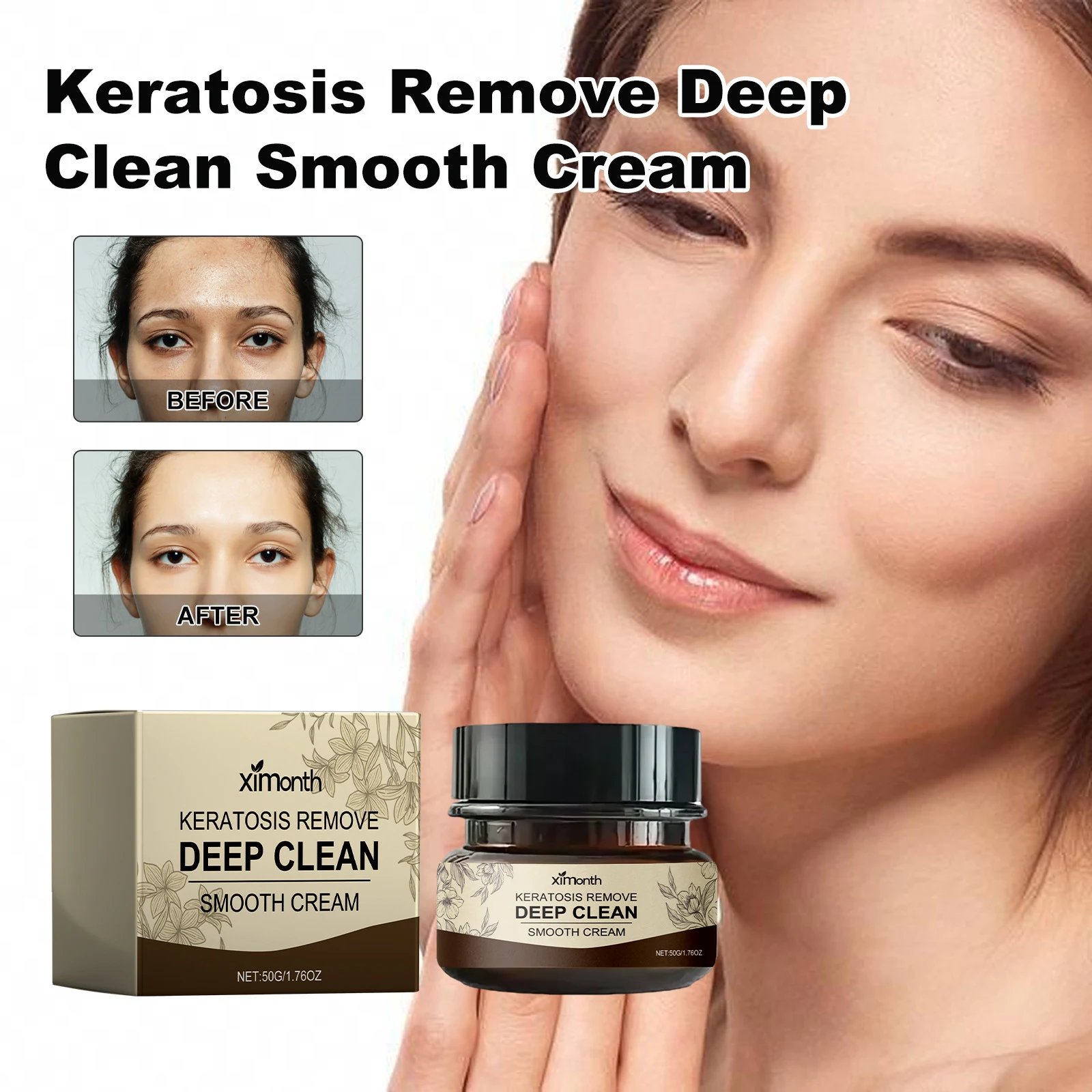 Title 1, Deep Cleansing Smooth Cream Cleanser for Acne P...