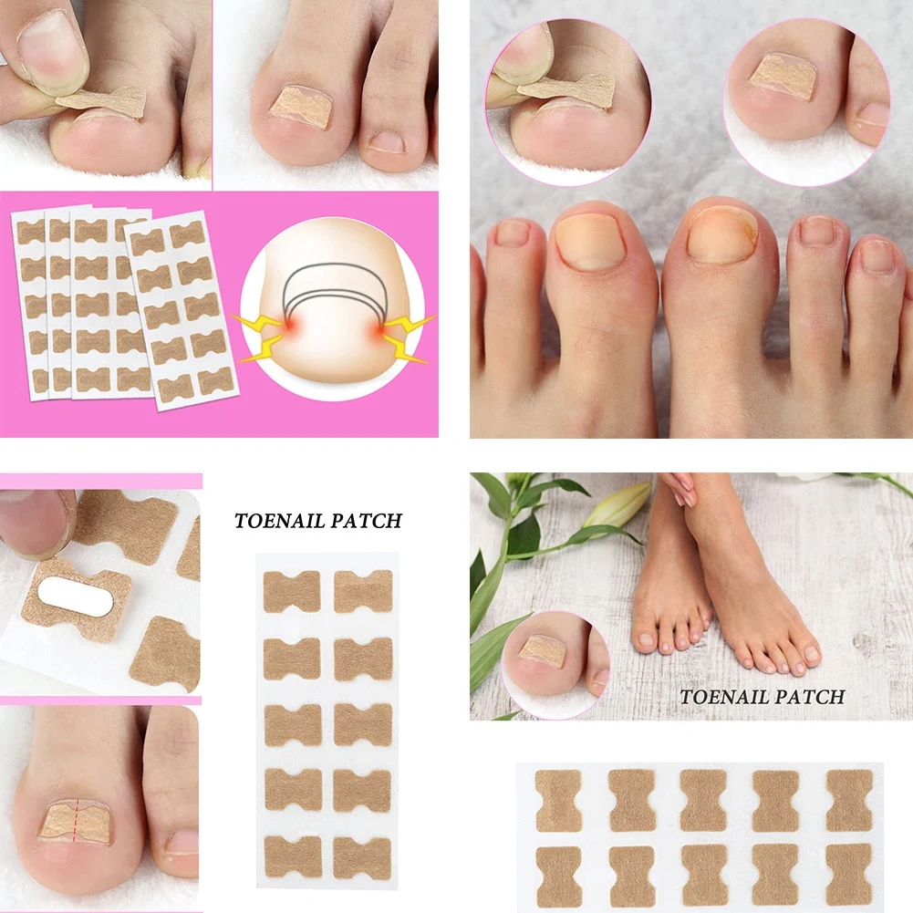 Title 1, Toe Nail Stickers
