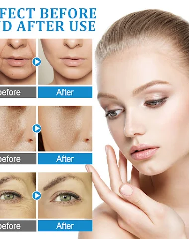 Image product - 2