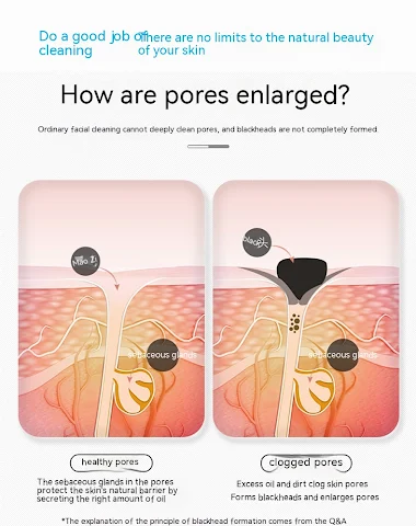 Image product - 3