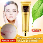 Creme de remoção de cicatrizes de acne e reparação da pele. Diminui cicatrizes, suaviza a pele e melhora a textura para uma pele mais lisa. — foto 5