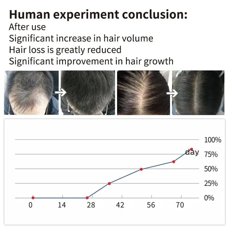 Hair Root Eyelash Growth Liquid, Hair Growth, Hair Renewal. Stimulates Growth, Strengthens Hair From Root to Tip for Thi — photo 6