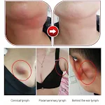 Patch Relax para alívio do estresse e promoção do relaxamento natural. Desfrute da calma diária, reduza a ansiedade e melhore seu bem-estar com este patch discreto. — foto 4
