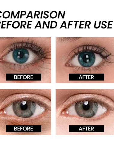 Image product - 0